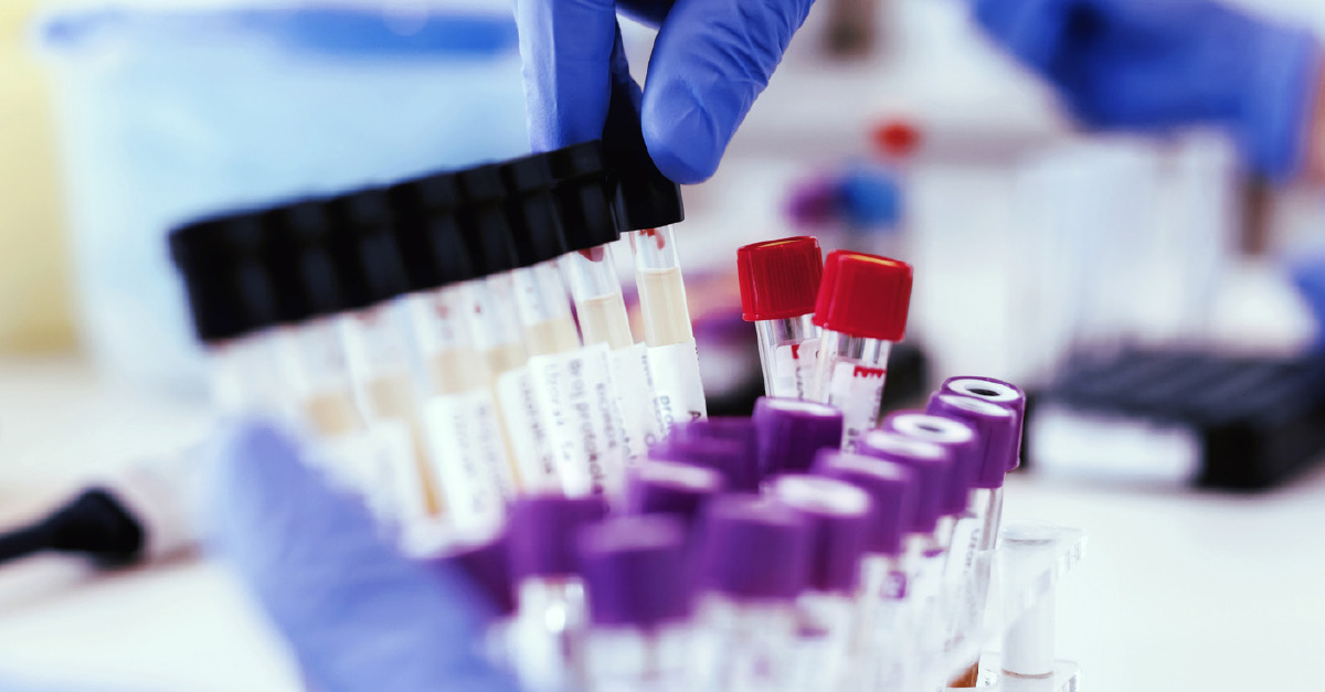 Instant Drug Testing vs. Lab-Based Testing: What You Need to ...